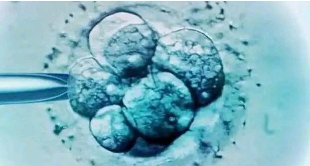 <b>-胚胎移植</b>