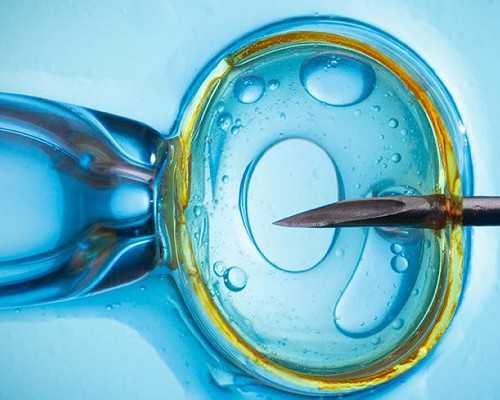 东莞各医院人工授精费用明细,东莞私立医院做第三代试管包生男孩要多少费用